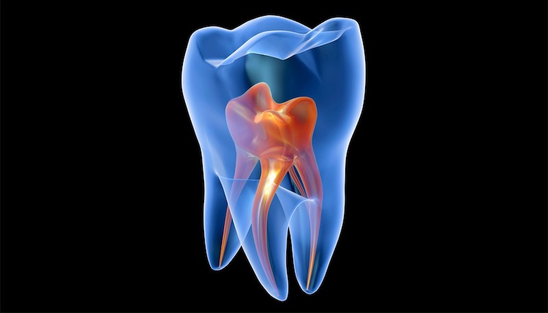Root canal therapy treatment at Harrison Family Dentistry in Chattanooga, TN
